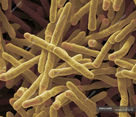 mycobacterium smegmatis|More.